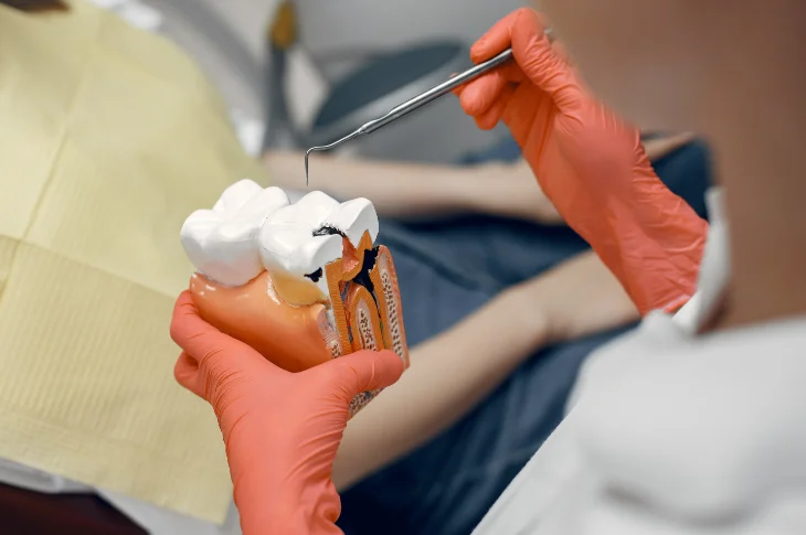 Kas ir endodontija un ieteikumi pirms procedūras