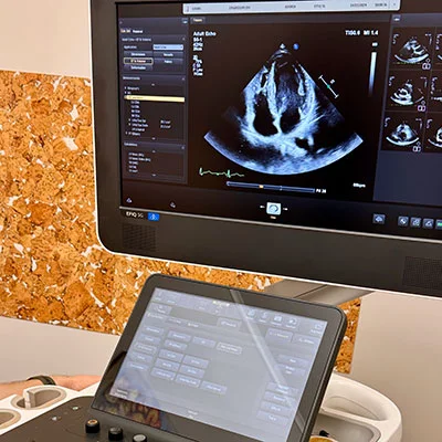Echocardiography (EHO) - attēls 2