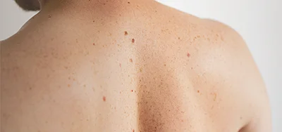 Dermatologs